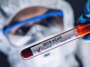 Coronavirus COVID 19 nCov-Ausbruch. Neues Corona-Virus-Blut-Reagenzglas vom Patienten. Positiver Fall von Korona-Virus Europa, Italien, Wuhan, China. Epidemische und pandemische Infektion : Stockfoto oder Stockvideo und Fotos, Bilder, Stockmedien von rcfotostock | RC-Photo-Stock